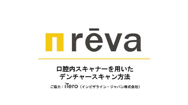 レジン床義歯スキャン方法