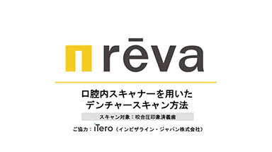 咬合圧印象済義歯スキャン方法