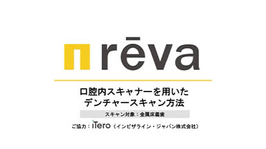 金属床義歯スキャン方法